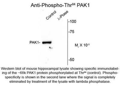 Western Blot: PAK1 [p Thr84] Antibody [NBP2-29511]